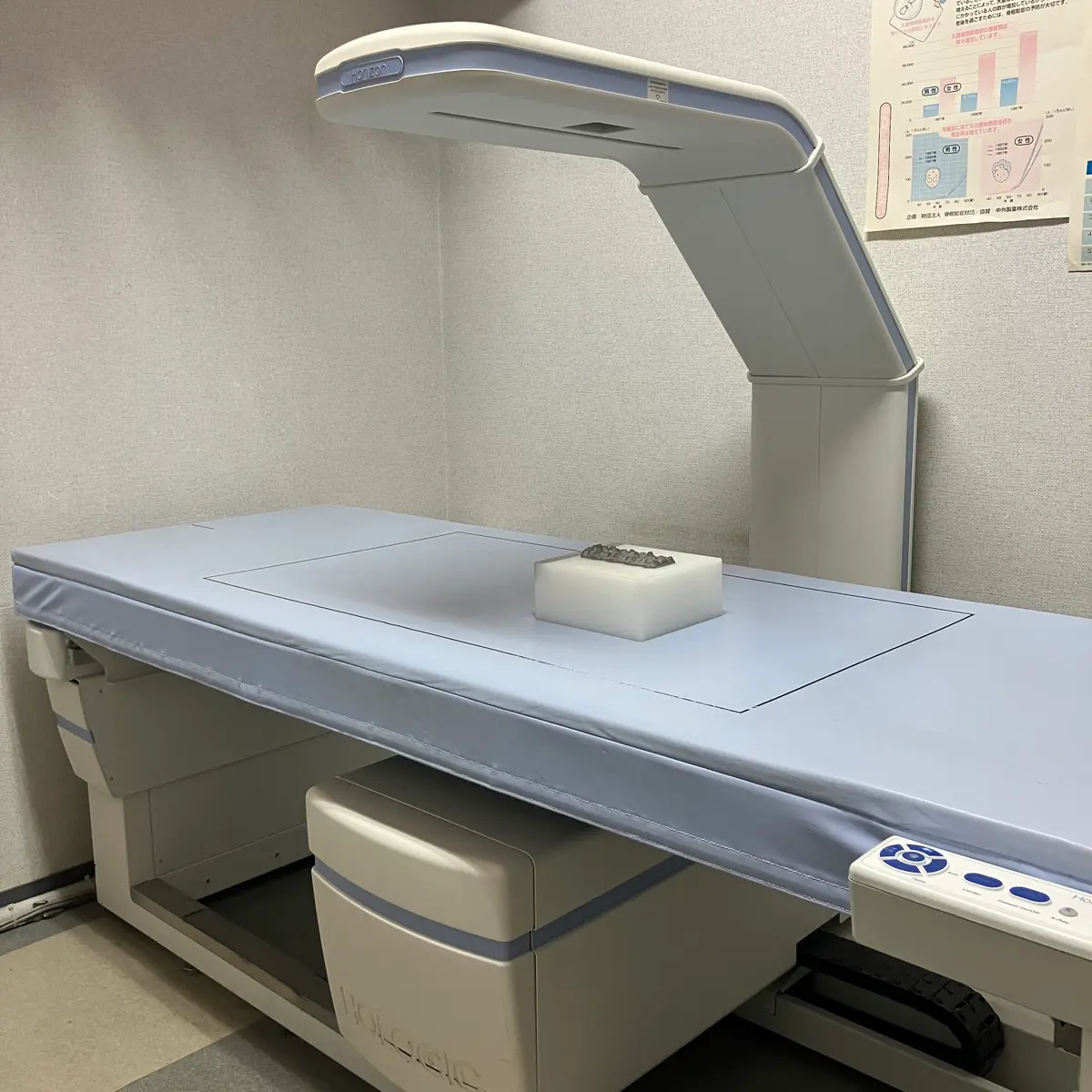DEXA